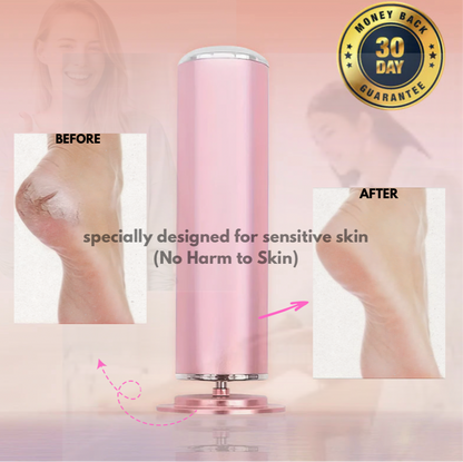 SilkHeel™ Foot Care Grinder